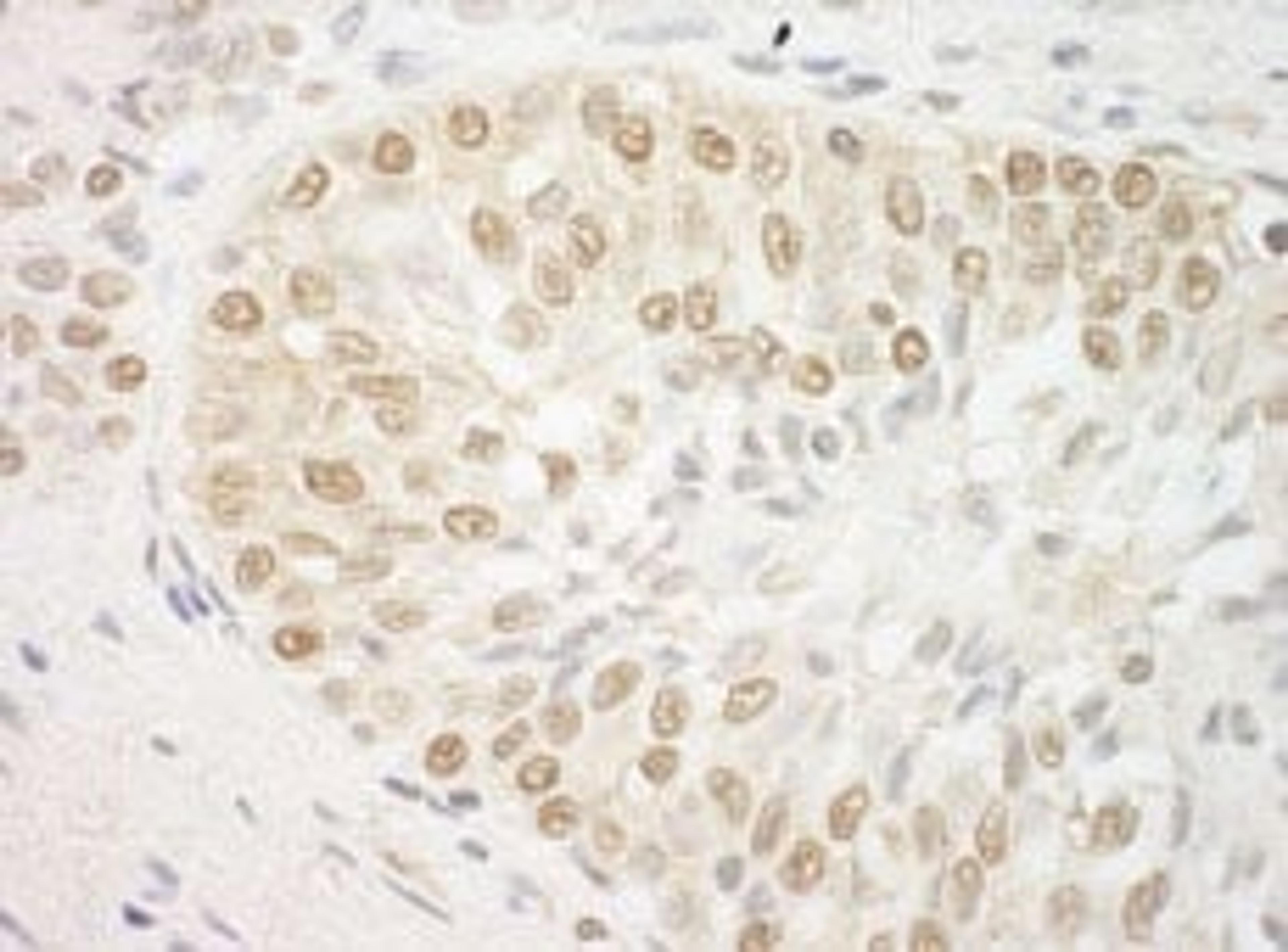 Detection of human ARID3B by immunohistochemistry.