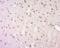 Immunohistochemical staining of rat brain tissue using GPR92 antibody.