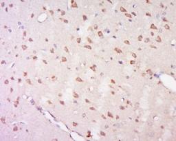 Immunohistochemical staining of rat brain tissue using GPR92 antibody.