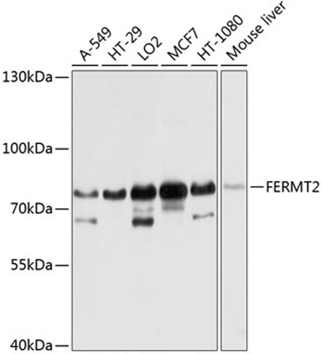 Western blot - FERMT2 antibody (A8709)