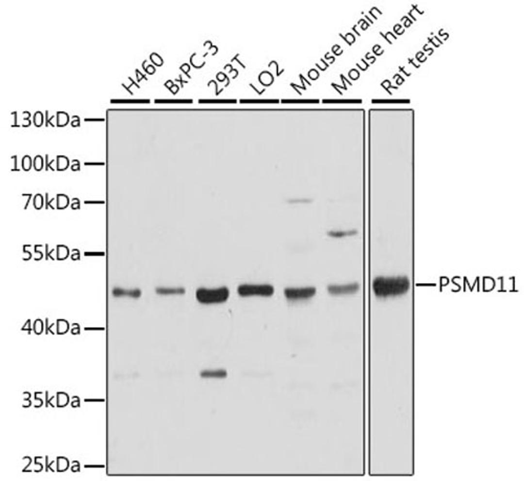 Western blot - PSMD11 antibody (A15306)