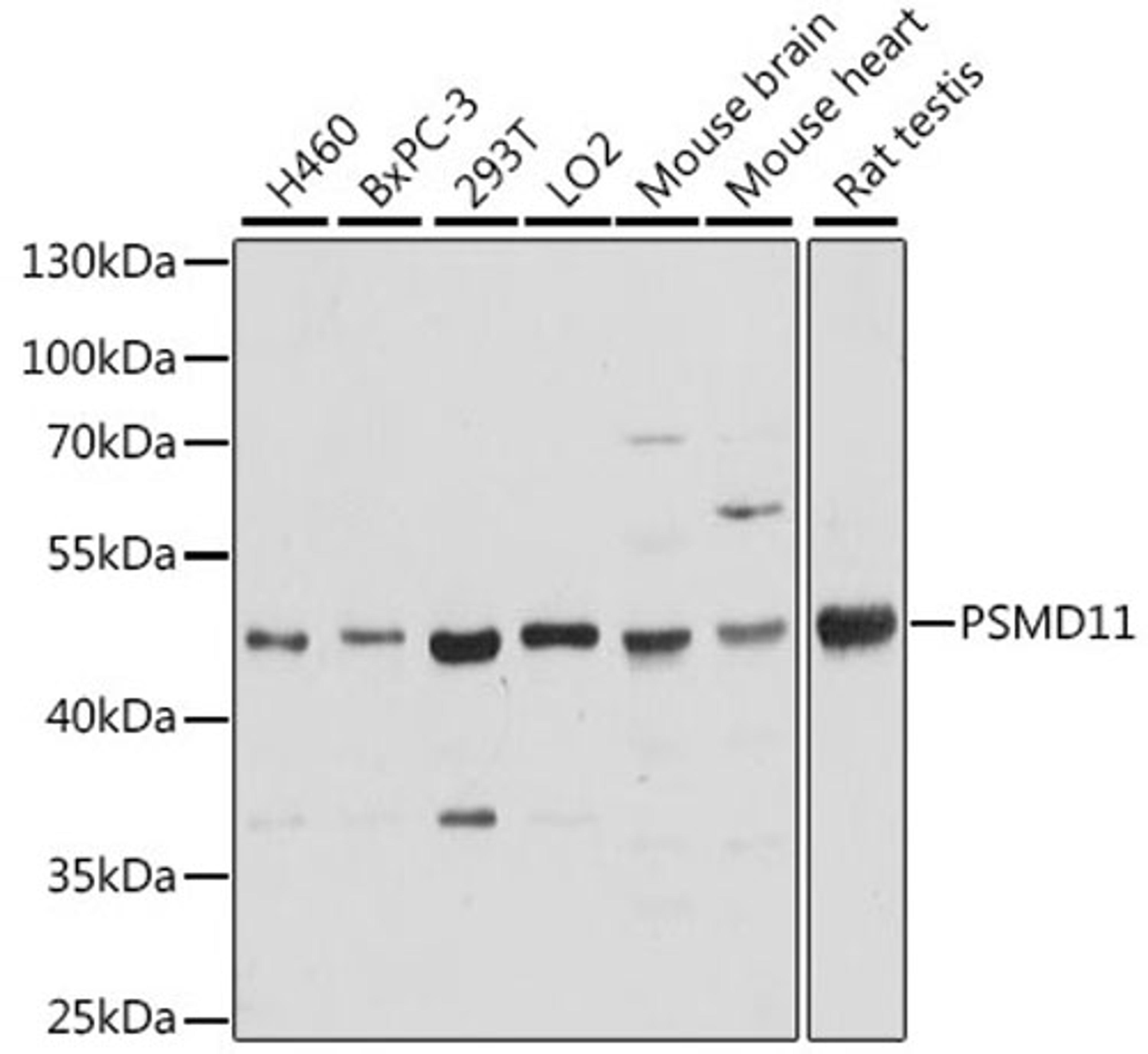 Western blot - PSMD11 antibody (A15306)