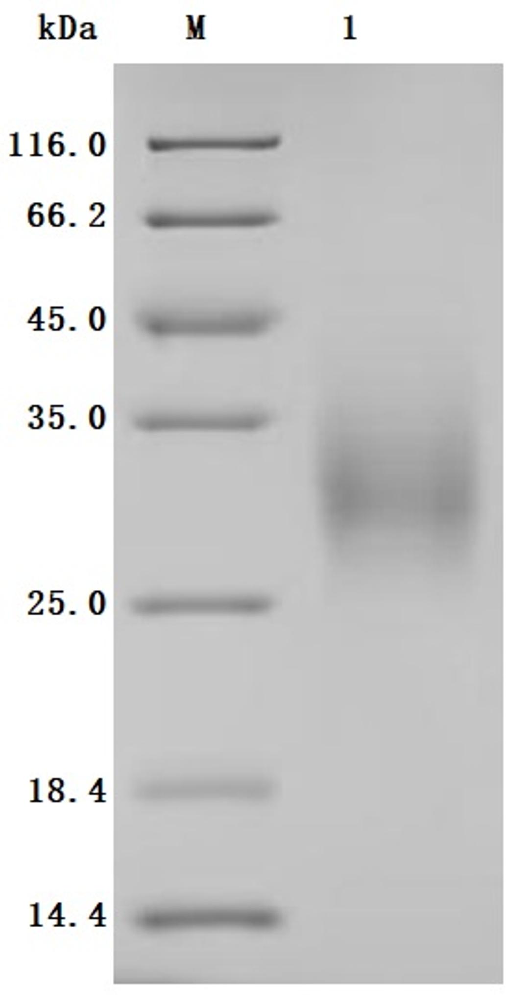 (Tris-Glycine gel) Discontinuous SDS-PAGE (reduced) with 5% enrichment gel and 15% separation gel.