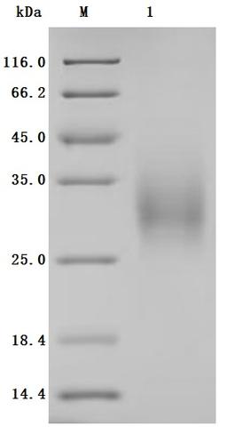 (Tris-Glycine gel) Discontinuous SDS-PAGE (reduced) with 5% enrichment gel and 15% separation gel.