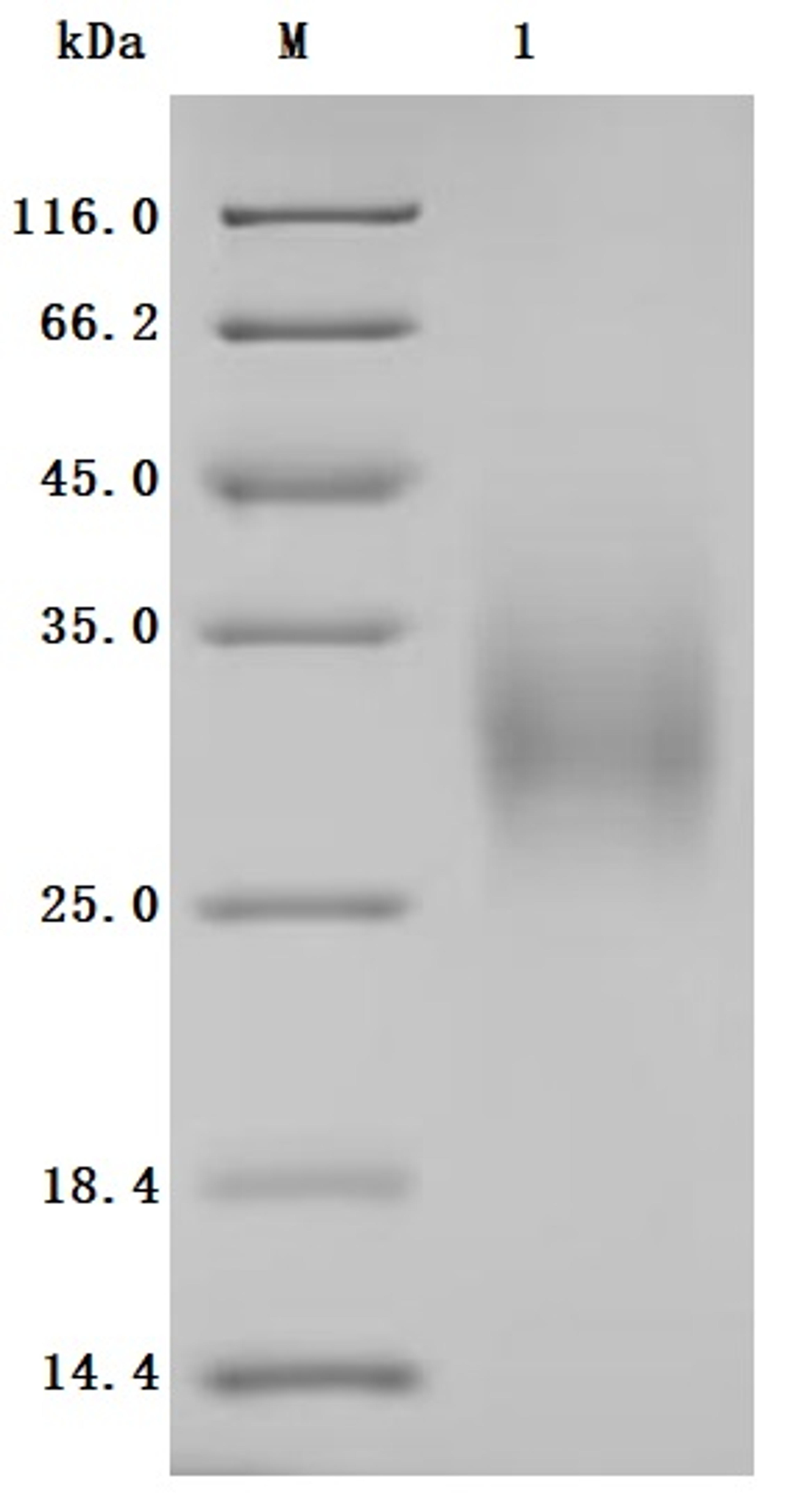 (Tris-Glycine gel) Discontinuous SDS-PAGE (reduced) with 5% enrichment gel and 15% separation gel.