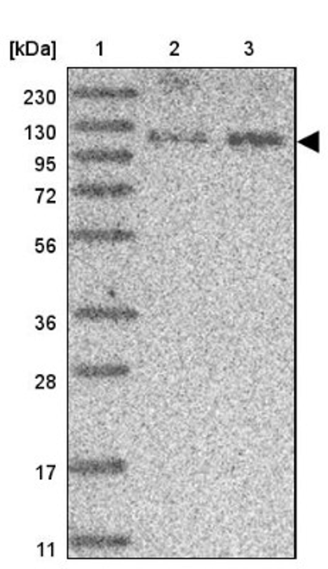 Western Blot: SCAF8/RBM16 Antibody [NBP2-34015] - Lane 1: Marker [kDa] 230, 130, 95, 72, 56, 36, 28, 17, 11<br/>Lane 2: Human cell line RT-4<br/>Lane 3: Human cell line U-251MG sp