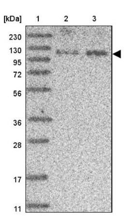 Western Blot: SCAF8/RBM16 Antibody [NBP2-34015] - Lane 1: Marker [kDa] 230, 130, 95, 72, 56, 36, 28, 17, 11<br/>Lane 2: Human cell line RT-4<br/>Lane 3: Human cell line U-251MG sp