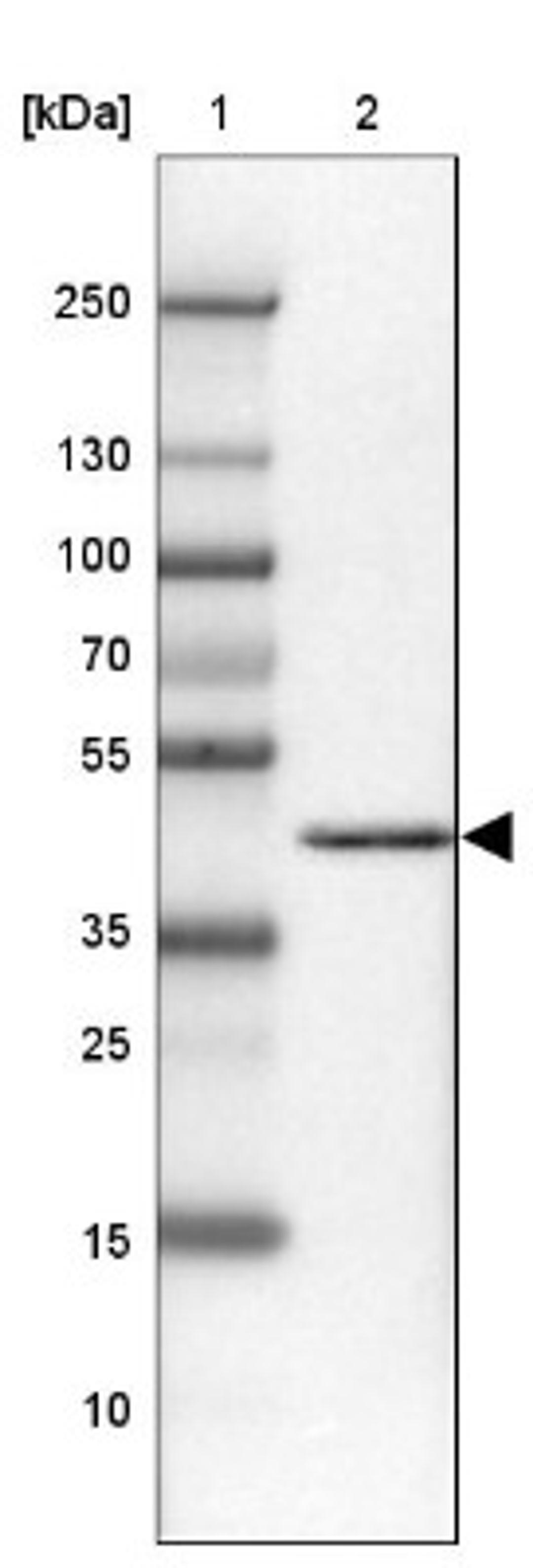 Western Blot: DEAF1 Antibody [NBP2-47489] - Lane 1: Marker [kDa] 250, 130, 100, 70, 55, 35, 25, 15, 10.  Lane 2: Human Analysis of liver tissue