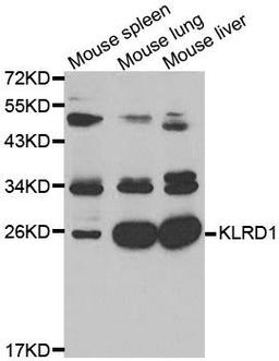 Western blot analysis of extracts of K562 cell lines using KLRD1 antibody