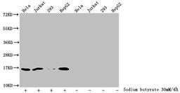Western Blot. Detected samples: Hela whole cell lysate, Jurkat whole cell lysate, 293 whole cell lysate, HepG2 whole cell lysate; Untreated (-) or treated (+) with 30mM sodium butyrate for 4h. All lanes: HIST1H3A antibody at 1:2000. Secondary. Goat polyclonal to rabbit IgG at 1/40000 dilution. Predicted band size: 16 kDa. Observed band size: 16 kDa