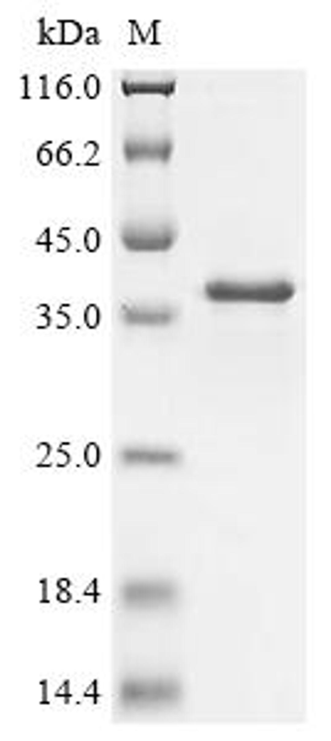 (Tris-Glycine gel) Discontinuous SDS-PAGE (reduced) with 5% enrichment gel and 15% separation gel.