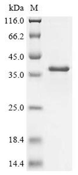 (Tris-Glycine gel) Discontinuous SDS-PAGE (reduced) with 5% enrichment gel and 15% separation gel.