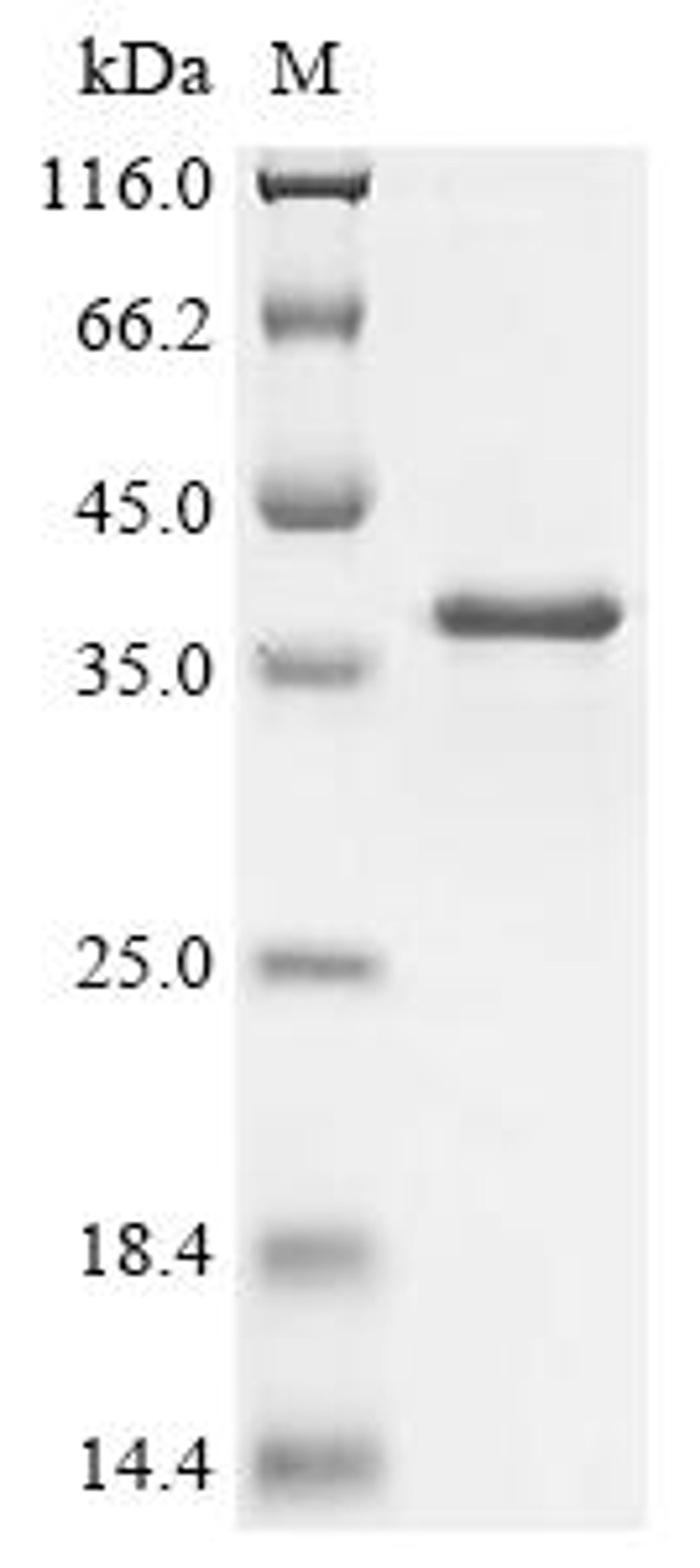(Tris-Glycine gel) Discontinuous SDS-PAGE (reduced) with 5% enrichment gel and 15% separation gel.