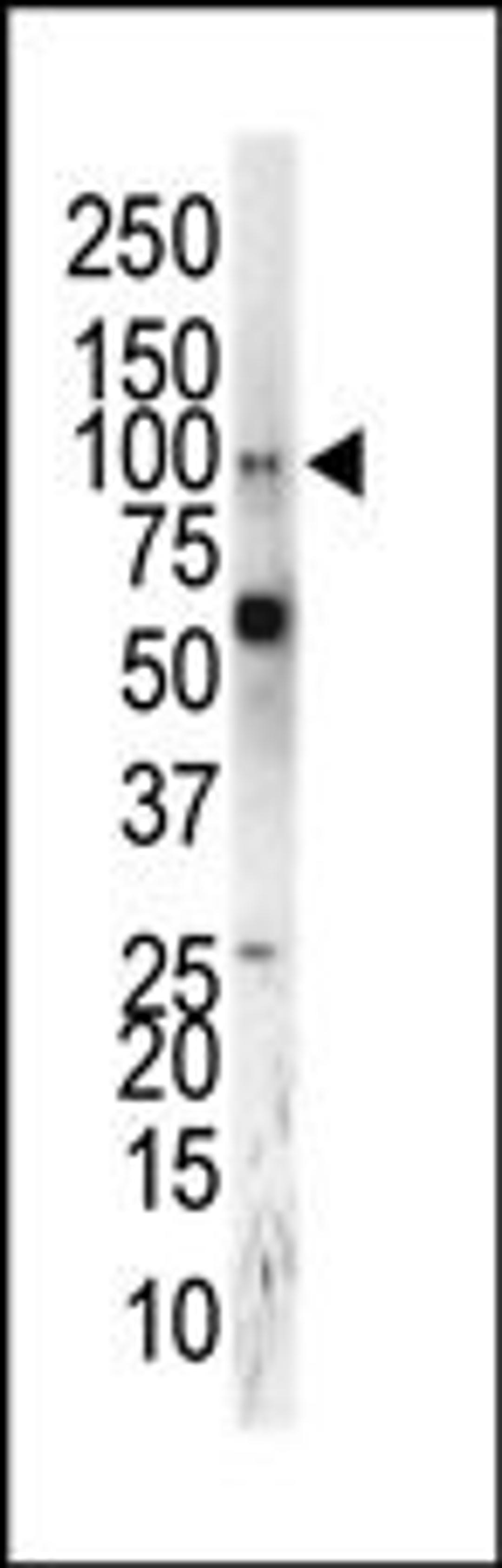 Western blot analysis of anti-EphA5 C-term Pab in mouse brain tissue