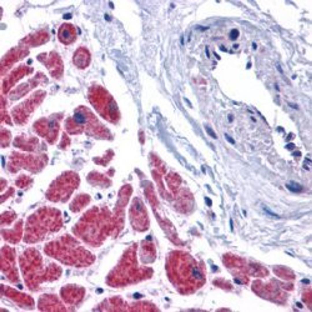 Staining of formalin fixed paraffin processed human heart tissue with Rabbit anti Mouse Caspase-12 