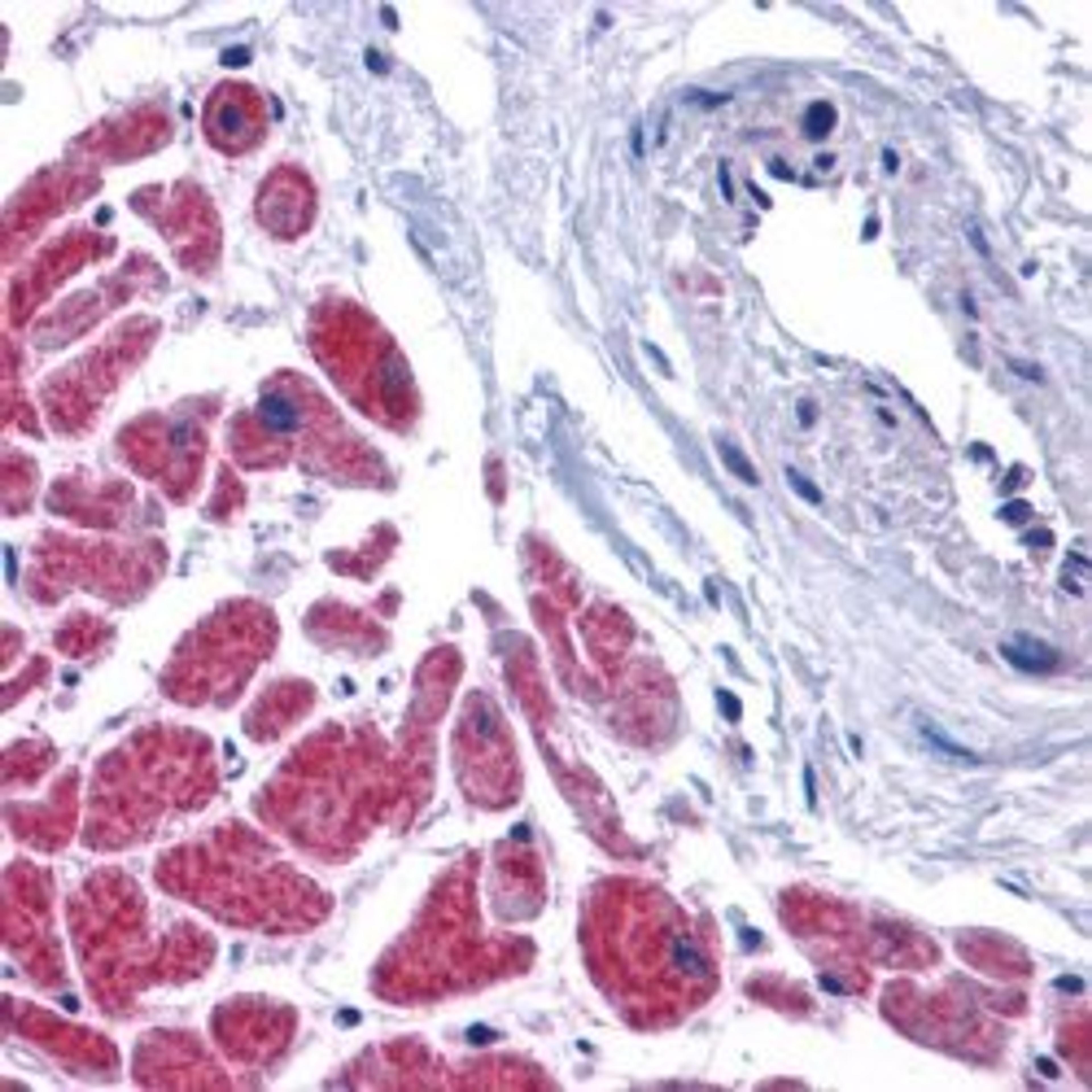 Staining of formalin fixed paraffin processed human heart tissue with Rabbit anti Mouse Caspase-12 