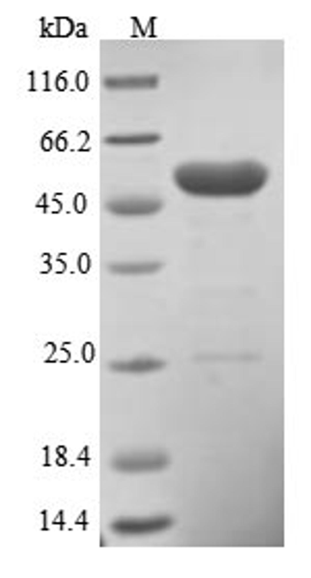 (Tris-Glycine gel) Discontinuous SDS-PAGE (reduced) with 5% enrichment gel and 15% separation gel.
