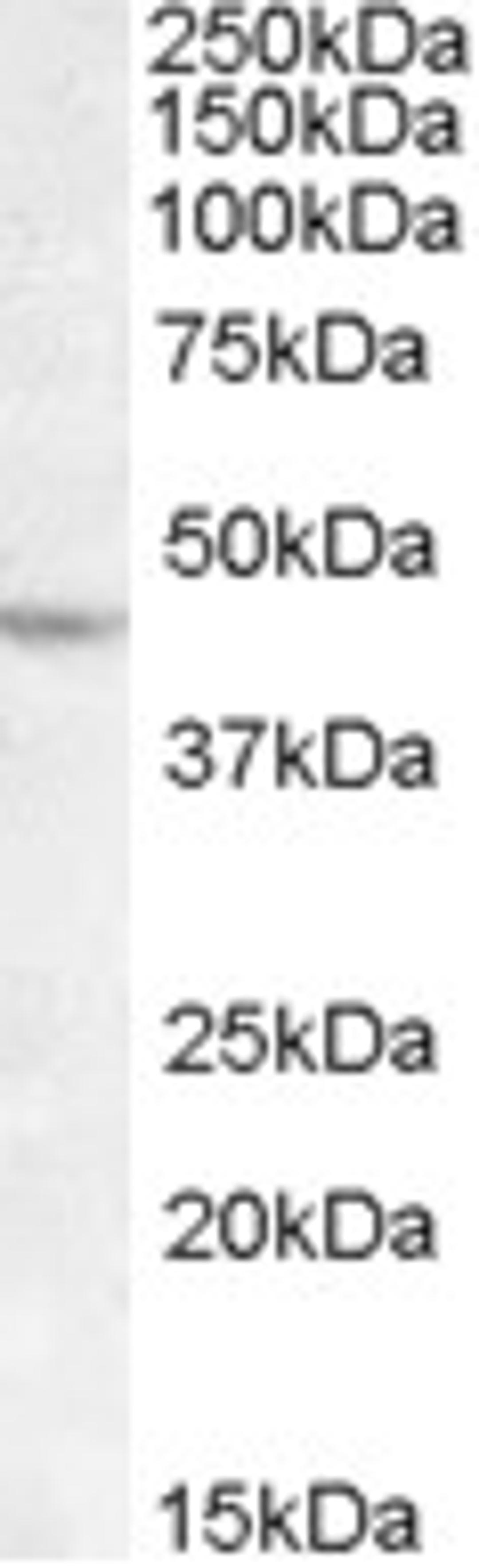 45-831 (1ug/ml) staining of DAUDI lysate (35ug protein in RIPA buffer). Primary incubation was 1 hour. Detected by chemiluminescence.