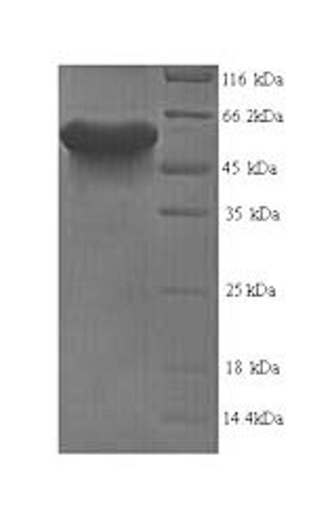 (Tris-Glycine gel) Discontinuous SDS-PAGE (reduced) with 5% enrichment gel and 15% separation gel.