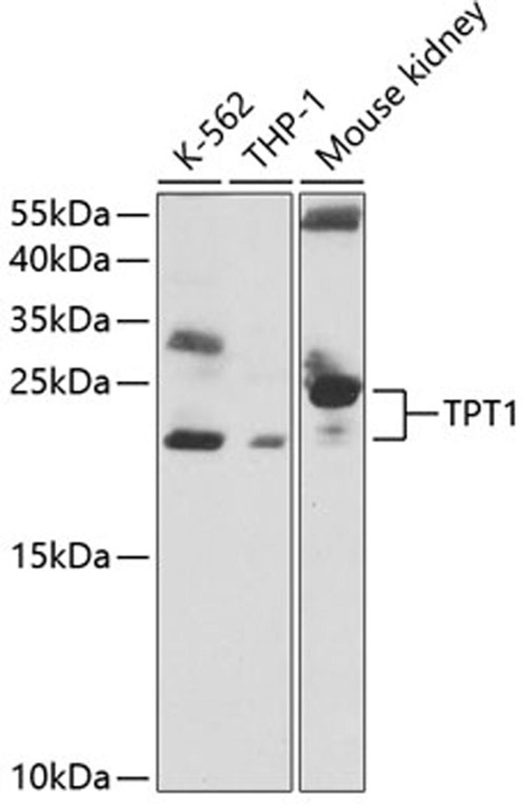 Western blot - TPT1 antibody (A13367)