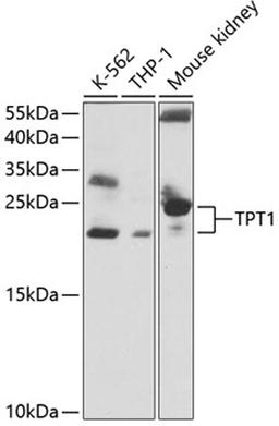 Western blot - TPT1 antibody (A13367)