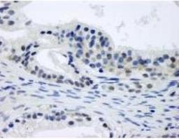 Immunohistochemistry-Paraffin: CSN1 Antibody [NB100-362] - FFPE section of human prostate-nodular hypertrophy. Affinity purified rabbit anti-CSN1 used at a dilution of 1:250. Detection: DAB staining using Immunohistochemistry Accessory Kit