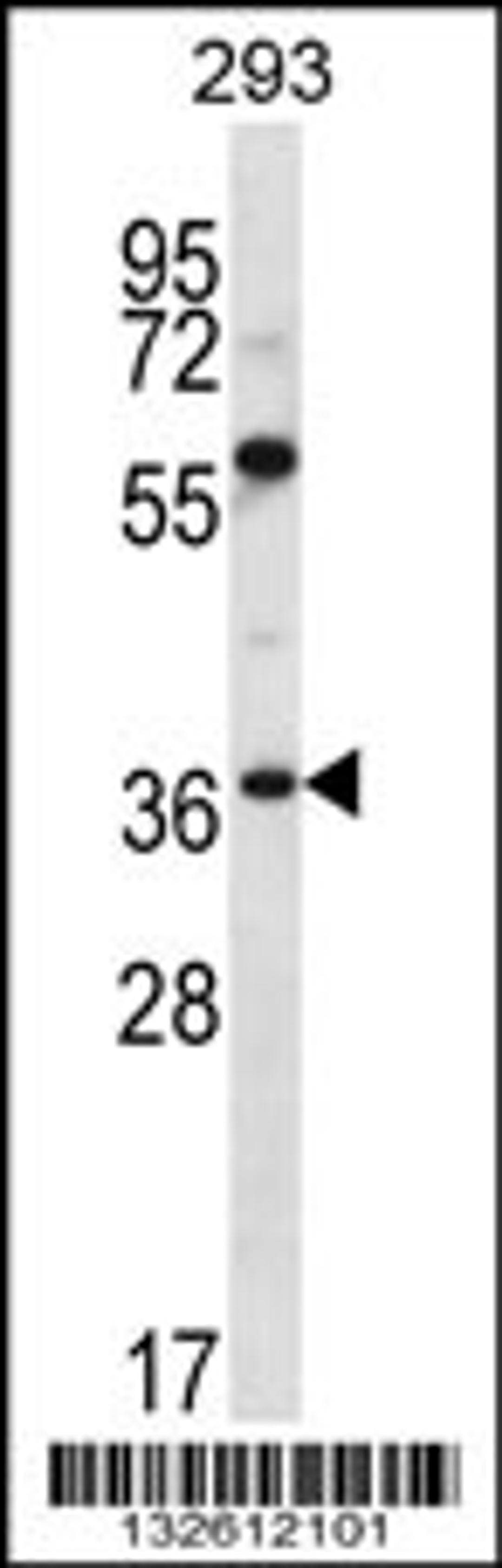 Western blot analysis in 293 cell line lysates (35ug/lane).