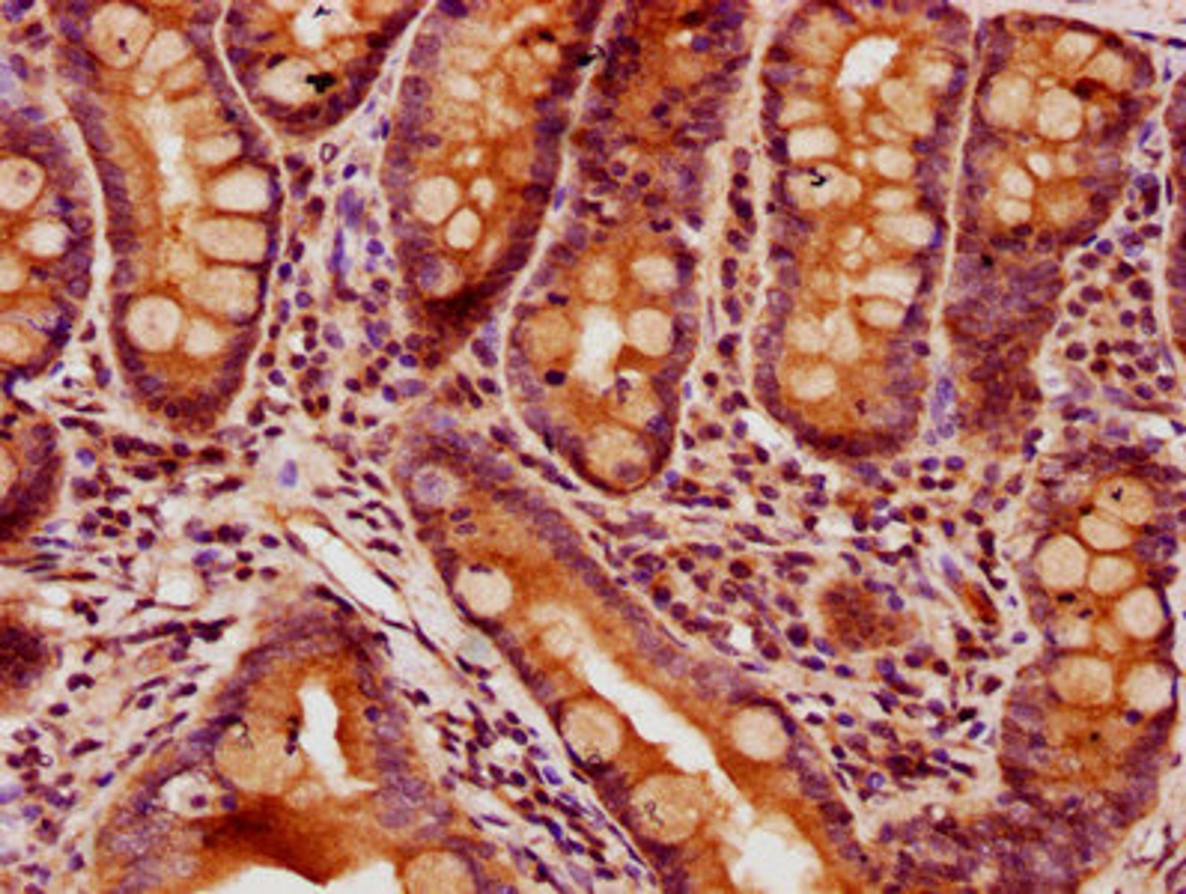 IHC image of CSB-PA885717LA01HU diluted at 1:400 and staining in paraffin-embedded human small intestine tissue performed on a Leica BondTM system. After dewaxing and hydration, antigen retrieval was mediated by high pressure in a citrate buffer (pH 6.0). Section was blocked with 10% normal goat serum 30min at RT. Then primary antibody (1% BSA) was incubated at 4&deg;C overnight. The primary is detected by a biotinylated secondary antibody and visualized using an HRP conjugated SP system.