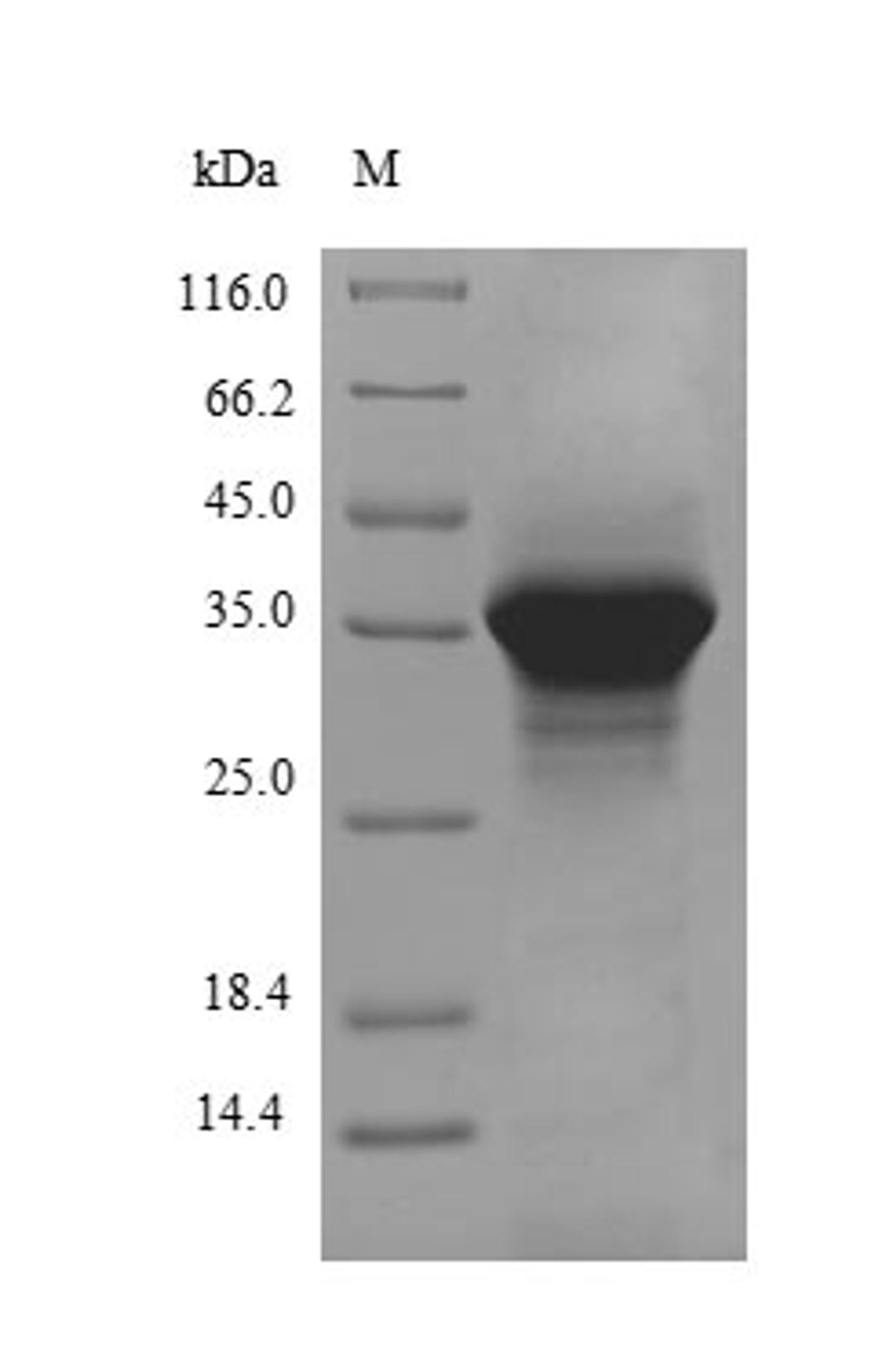 (Tris-Glycine gel) Discontinuous SDS-PAGE (reduced) with 5% enrichment gel and 15% separation gel.