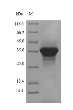 (Tris-Glycine gel) Discontinuous SDS-PAGE (reduced) with 5% enrichment gel and 15% separation gel.