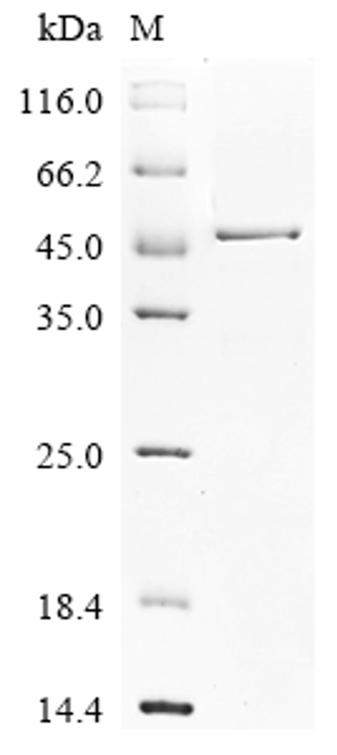 (Tris-Glycine gel) Discontinuous SDS-PAGE (reduced) with 5% enrichment gel and 15% separation gel.