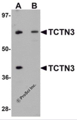 Western blot analysis of TCTN3 in HeLa cell lysate with TCTN3 antibody at (A) 1 and (B) 2&#956;g/mL.