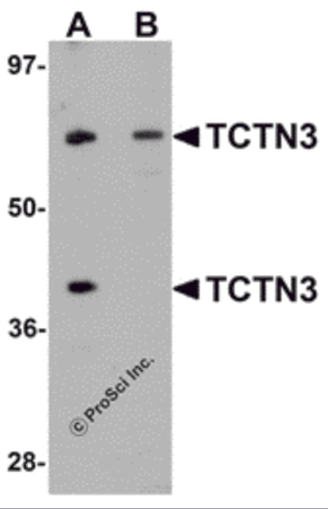 Western blot analysis of TCTN3 in HeLa cell lysate with TCTN3 antibody at (A) 1 and (B) 2μg/mL.