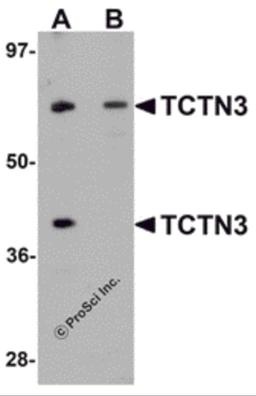 Western blot analysis of TCTN3 in HeLa cell lysate with TCTN3 antibody at (A) 1 and (B) 2μg/mL.