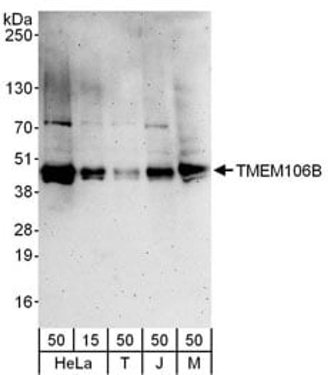 Detection of human and mouse TMEM106B by western blot.