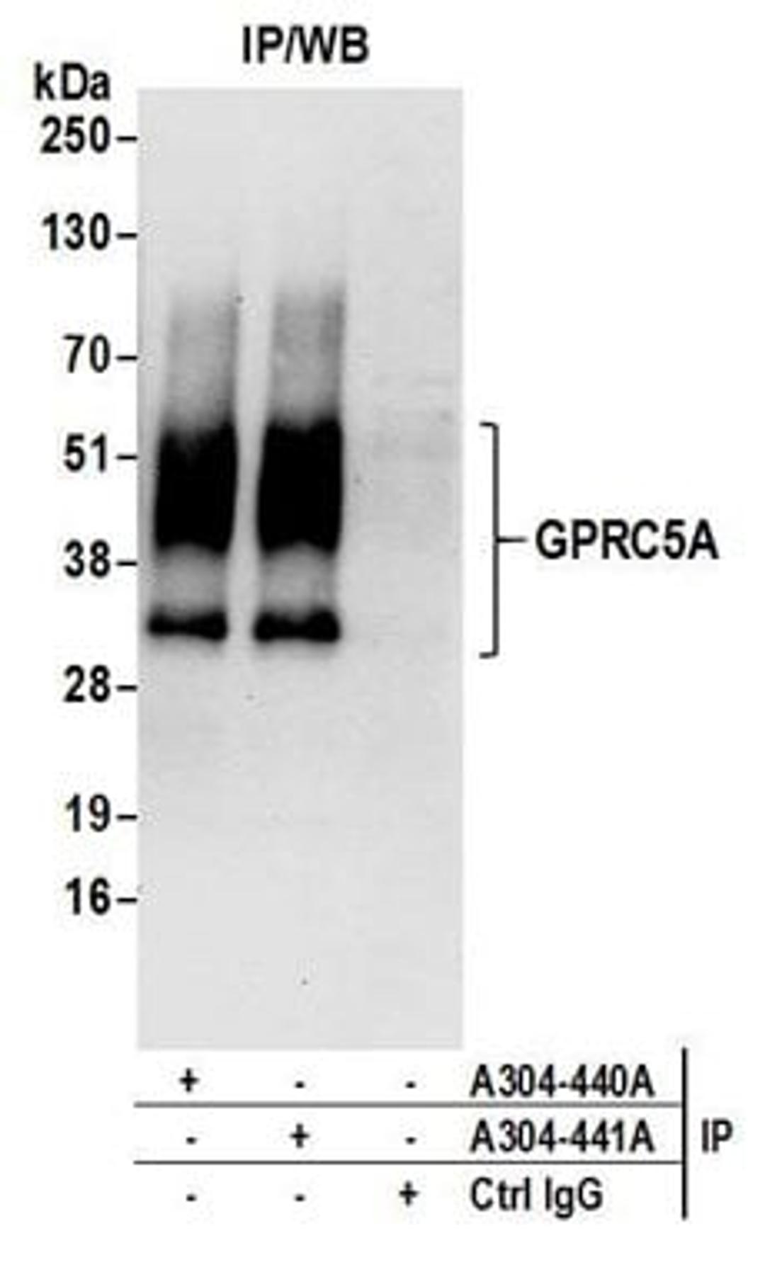 Detection of human GPRC5A by western blot of immunoprecipitates.