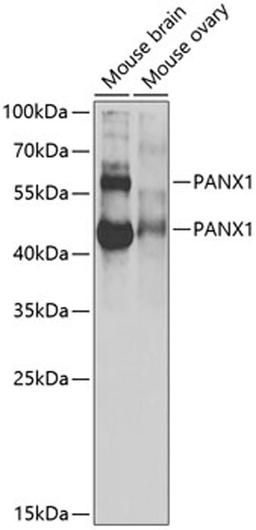 Western blot - PANX1 antibody (A13587)