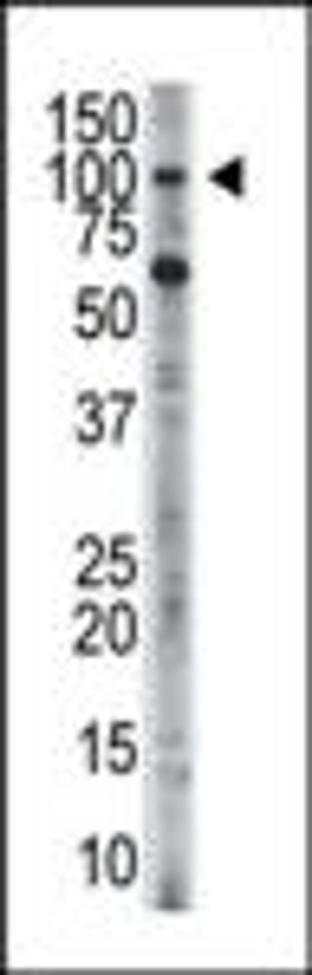 Antibody is used in Western blot to detect HK3 in HL-60 cell lysate.