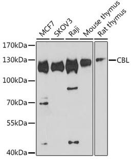 Western blot - CBL antibody (A0732)