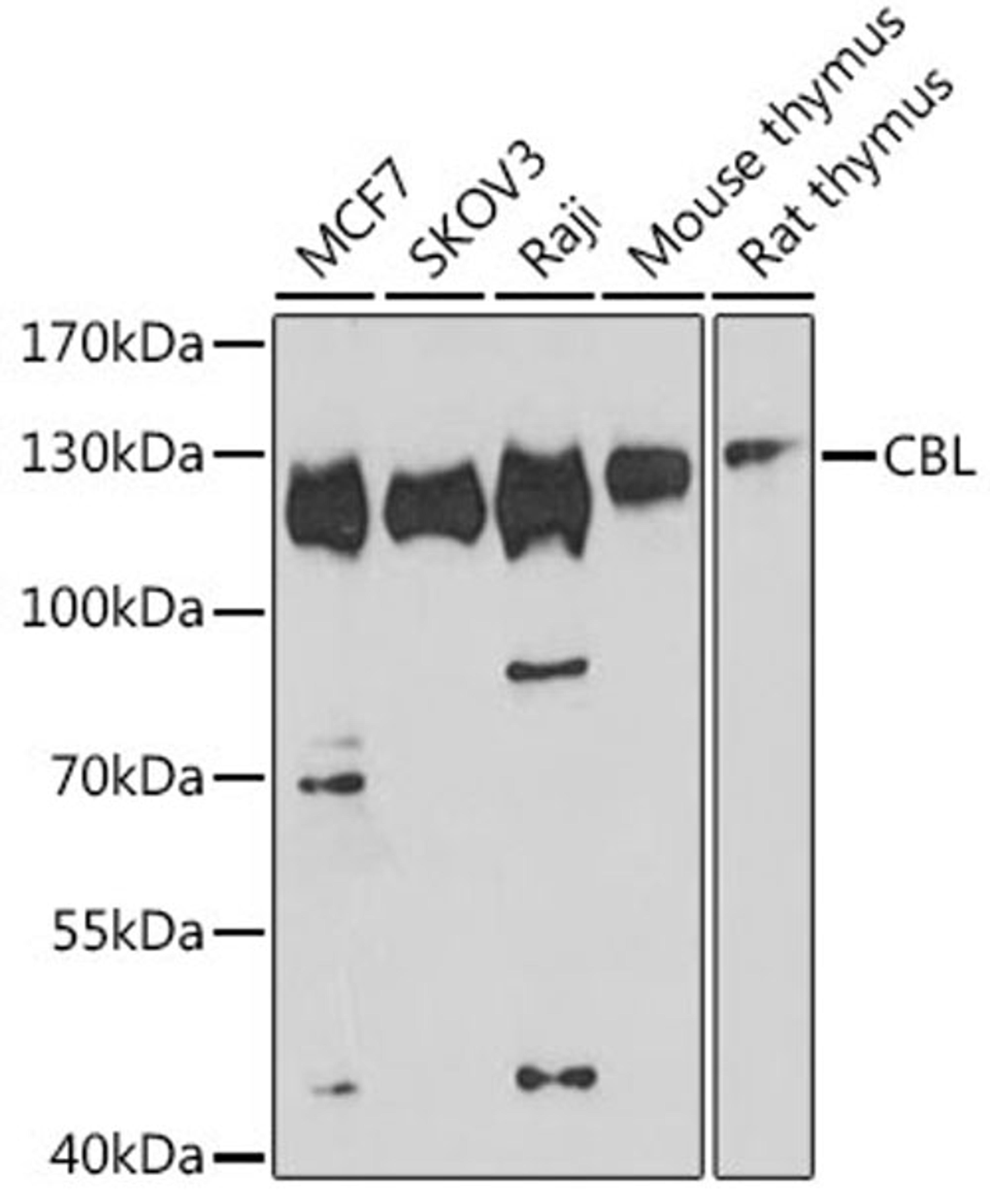 Western blot - CBL antibody (A0732)