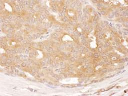 Detection of human DYNC1LI1 by immunohistochemistry.