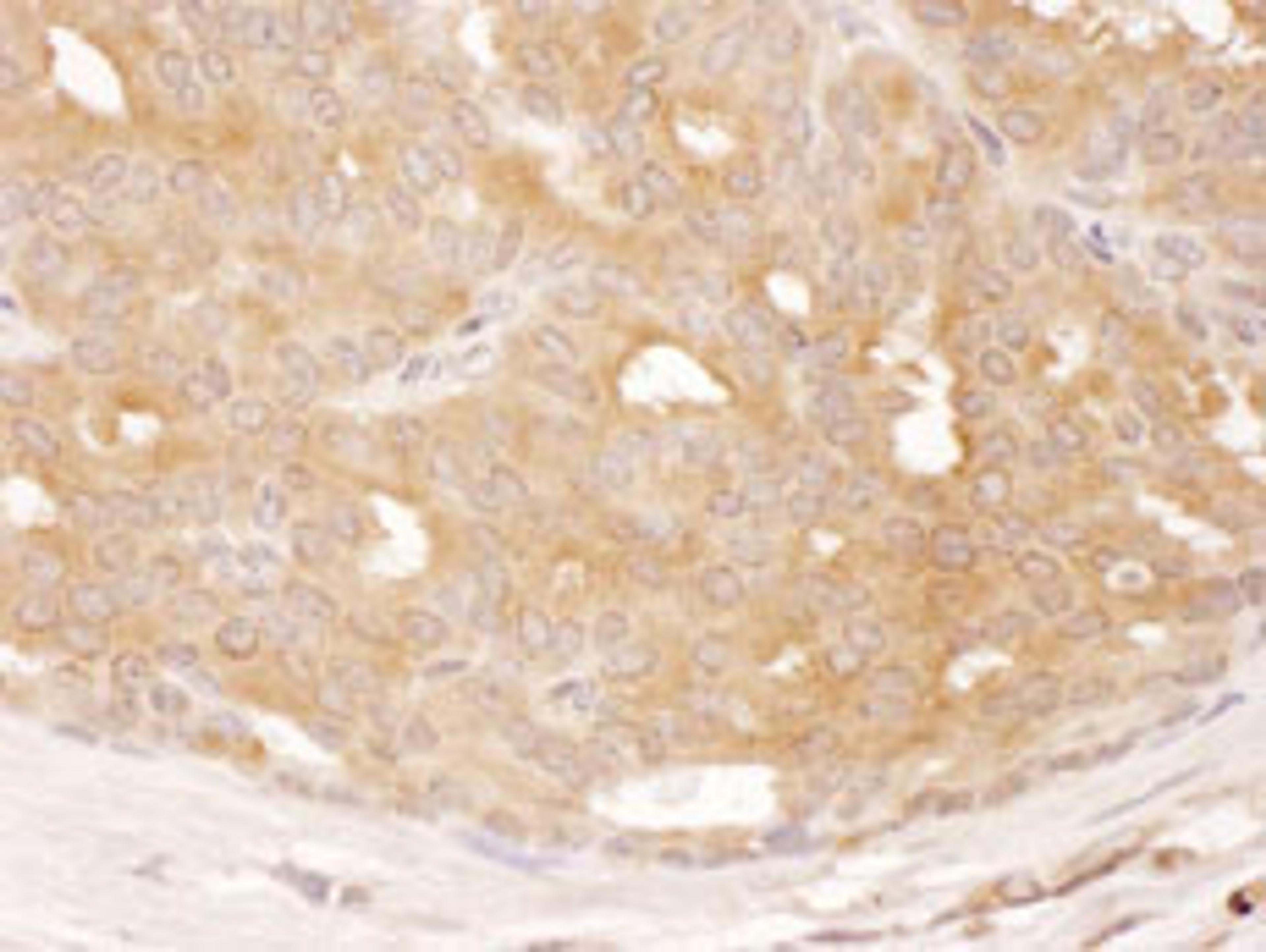 Detection of human DYNC1LI1 by immunohistochemistry.