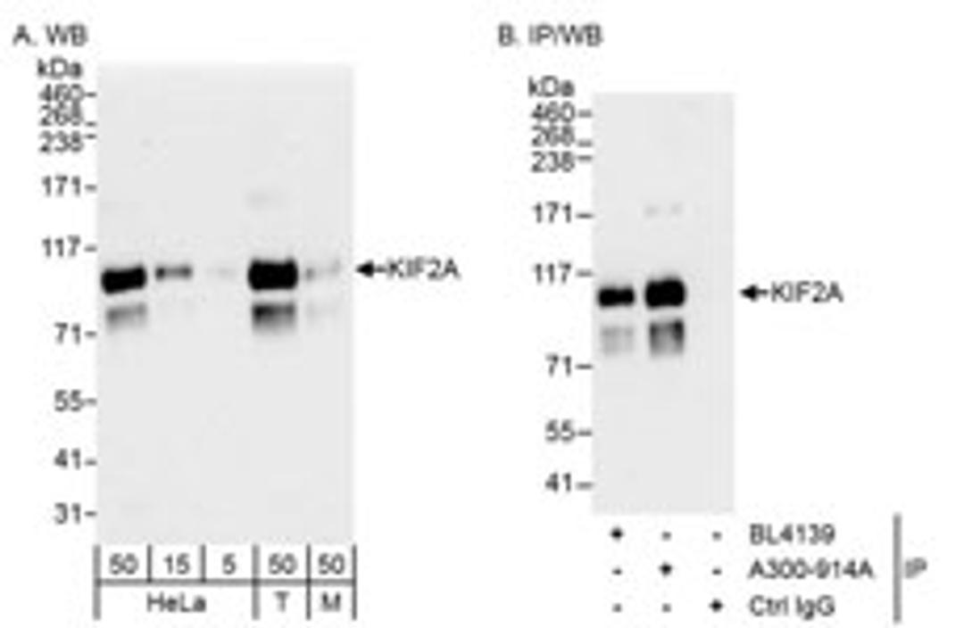 Detection of human and mouse KIF2A by western blot (h&m) and immunoprecipitation (h).