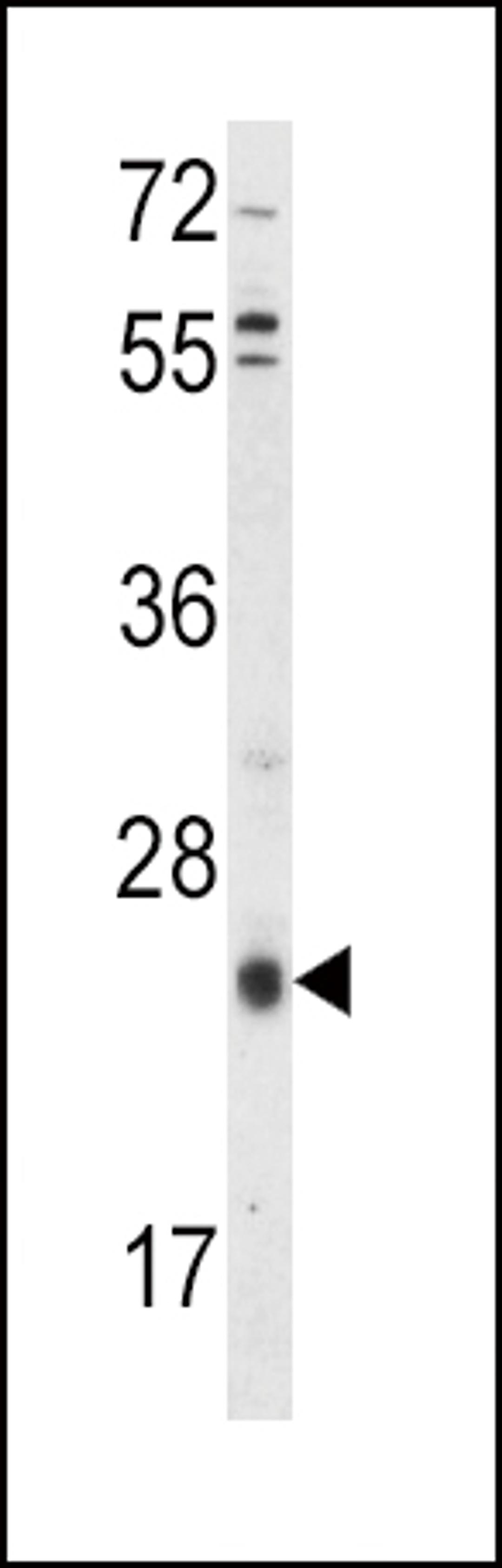 Western blot analysis of TIMP3 Antibody in HepG2 cell line lysates (35ug/lane)