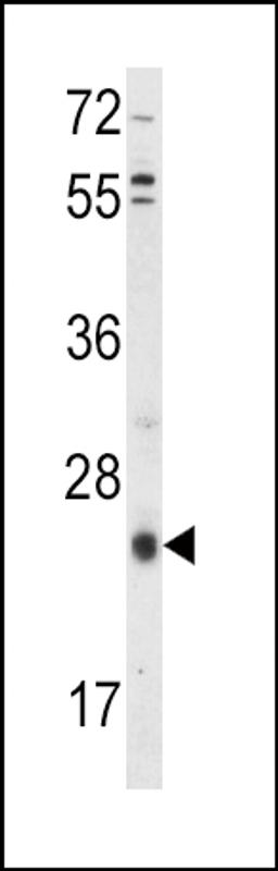 Western blot analysis of TIMP3 Antibody in HepG2 cell line lysates (35ug/lane)