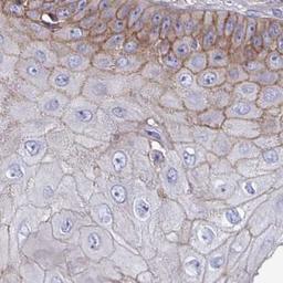 Immunohistochemistry: SYT10 Antibody [NBP2-31604] - skin cancer