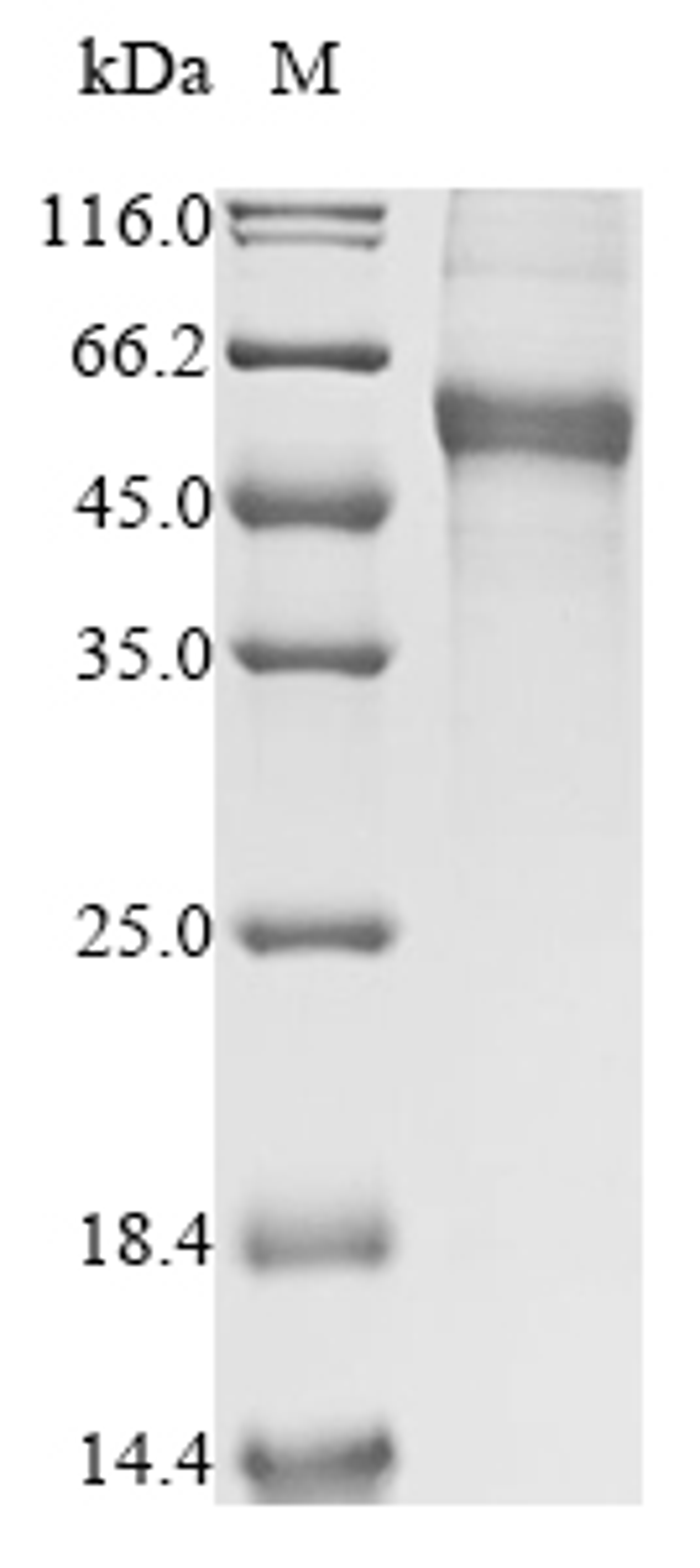 (Tris-Glycine gel) Discontinuous SDS-PAGE (reduced) with 5% enrichment gel and 15% separation gel.