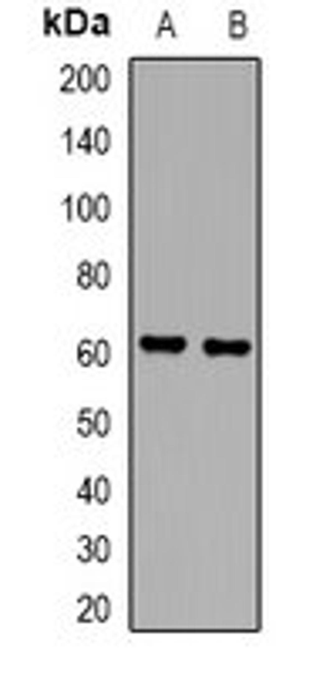 Western blot analysis of HepG2 (Lane1), HuvEc (Lane2) whole cell lysates using MIA2 antibody