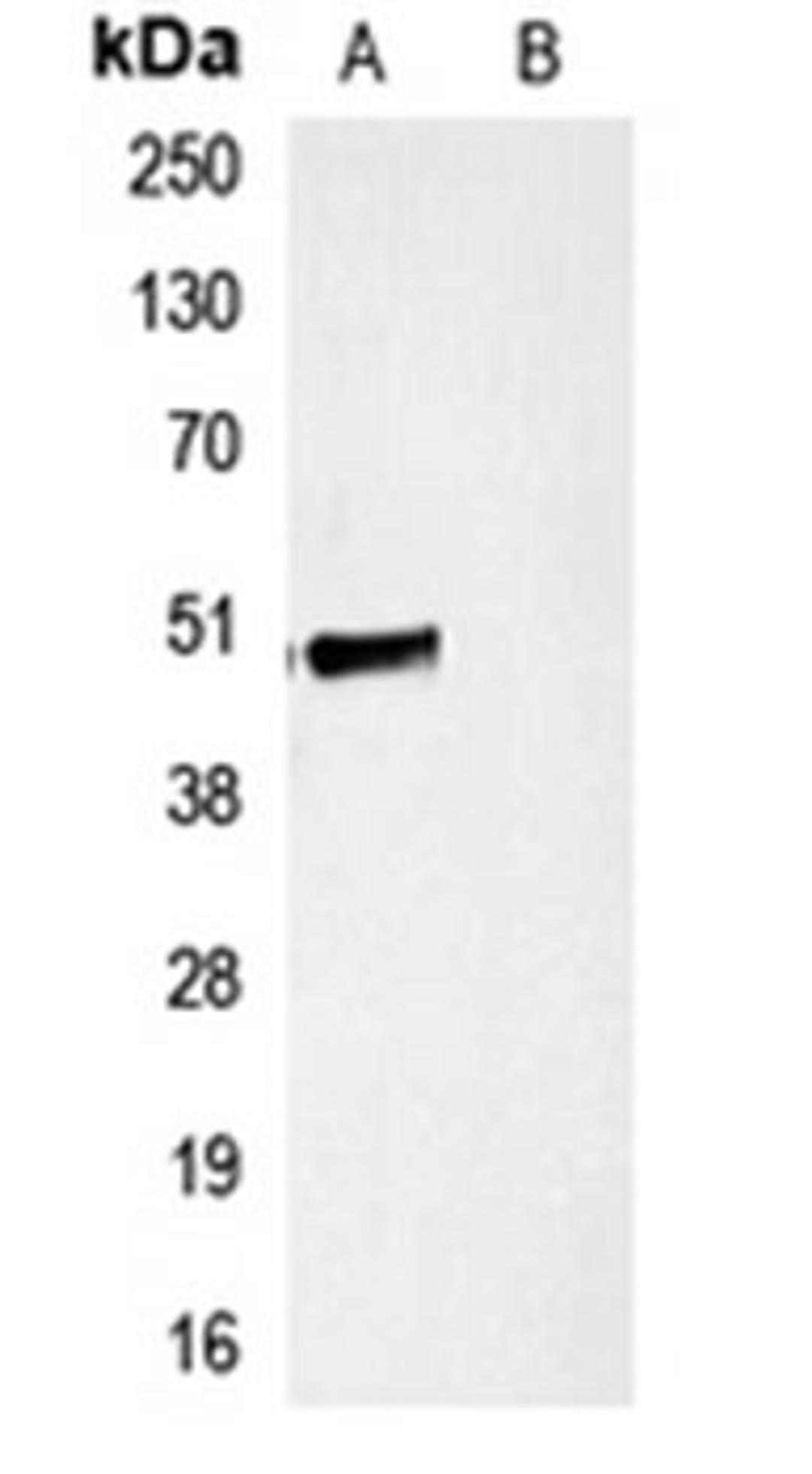 Western blot analysis of HEK293T cells transfected with vector overexpressing HA tag (Lane 1) and untransfected (Lane 2) using HA-tag antibody