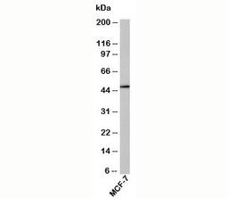 Western blot testing of human samples with RUNX2 antibody at 1ug/ml. Predicted molecular weight: 50-60 kDa.